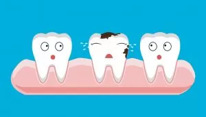 Read more about the article What You Need To Know About Tooth Decay