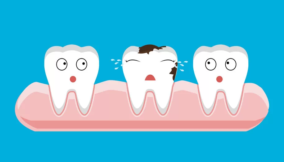 You are currently viewing What You Need To Know About Tooth Decay