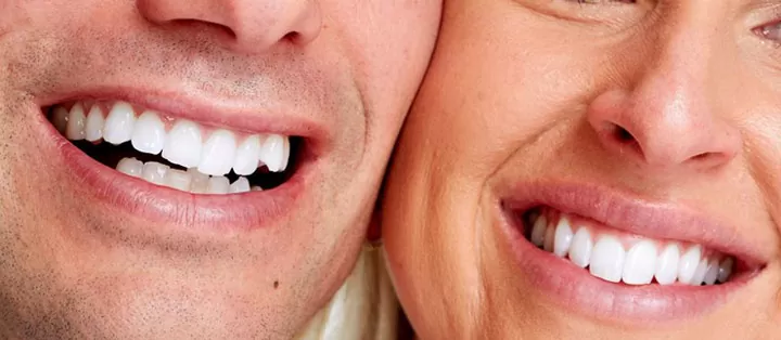 Read more about the article What exactly happens during teeth whitening?